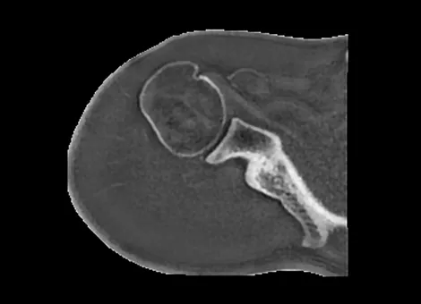 Isotropic-3D-imaging