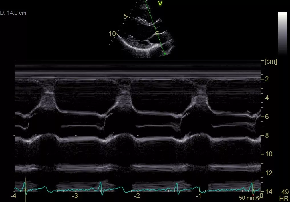 ound-vivid-vivid s60-quantification-gehc_vivid_s70_3sc_anatomical_mmode_quantification_jpg
