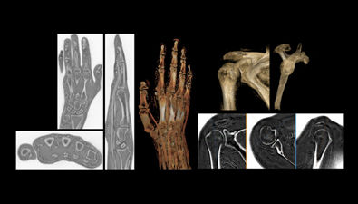 oZTEo-for-MR-bone-imaging-content