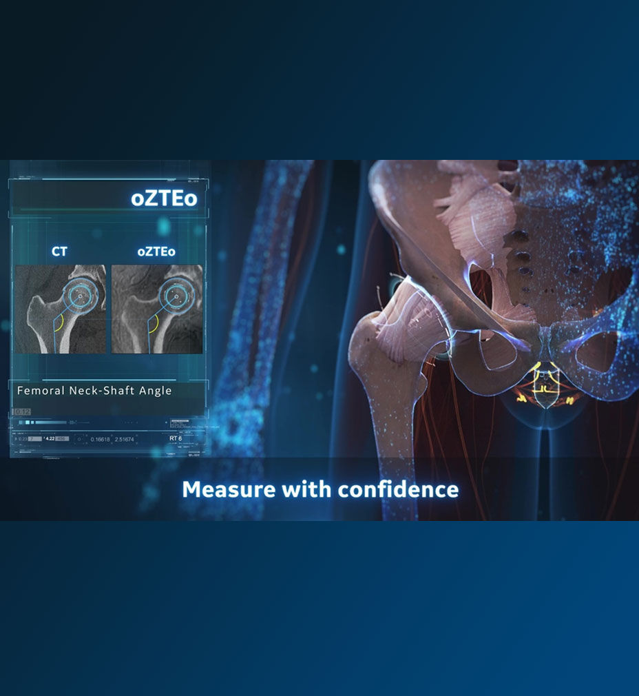oZTEo MR bone imaging ease-patient burden