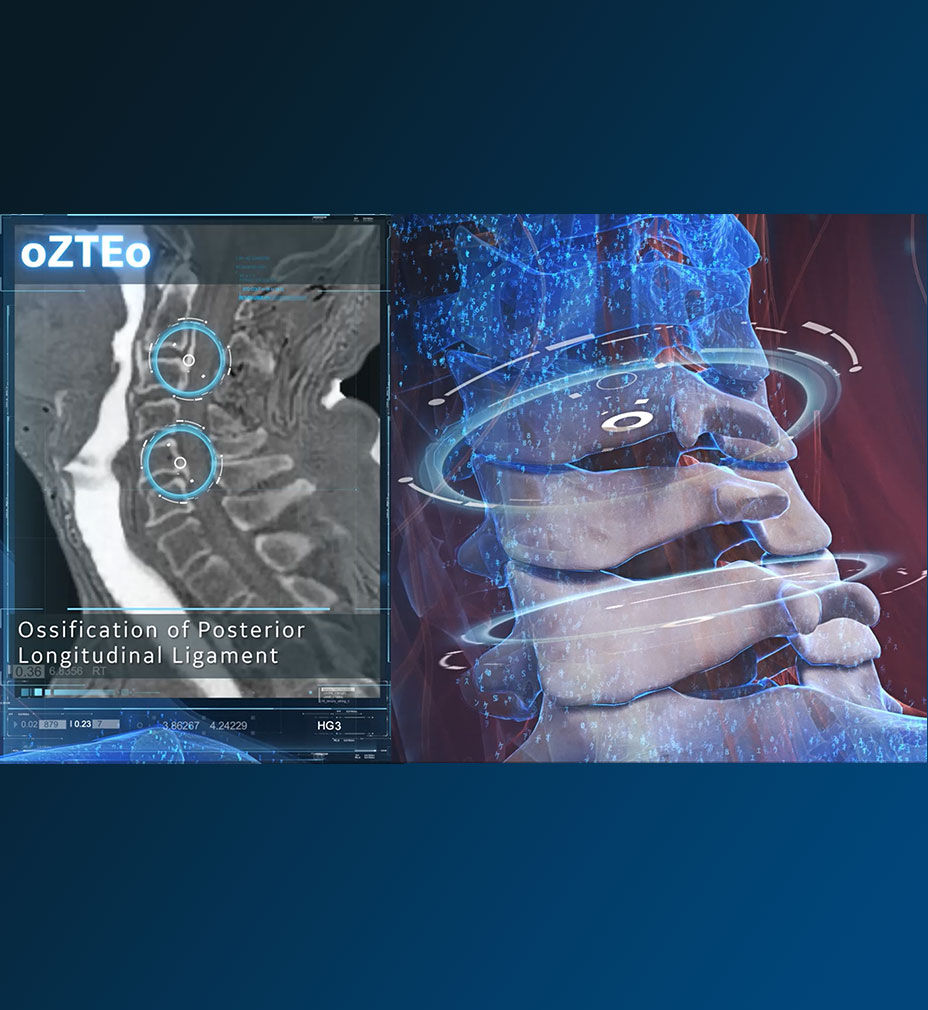 oZTEo MR bone imaging one stop orthopedic shop