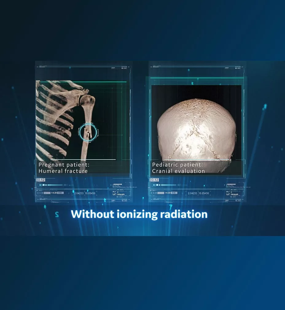 oZTEo MR bone imaging sharp constast