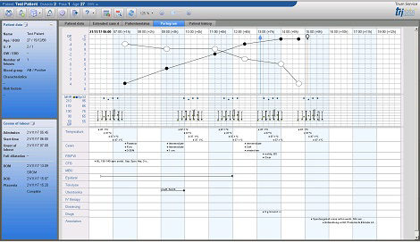 Partogram_EN_new