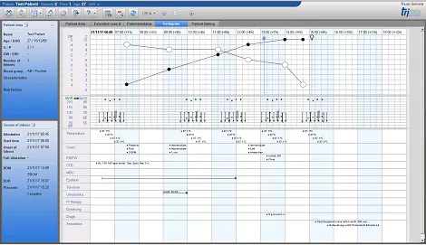 Partogram_EN_new