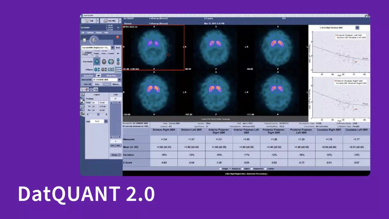 pdx-global-neurology-datquant-product-demo