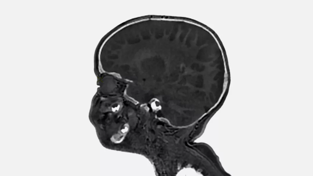 Pediatric-MRI-product-switcher-desktop