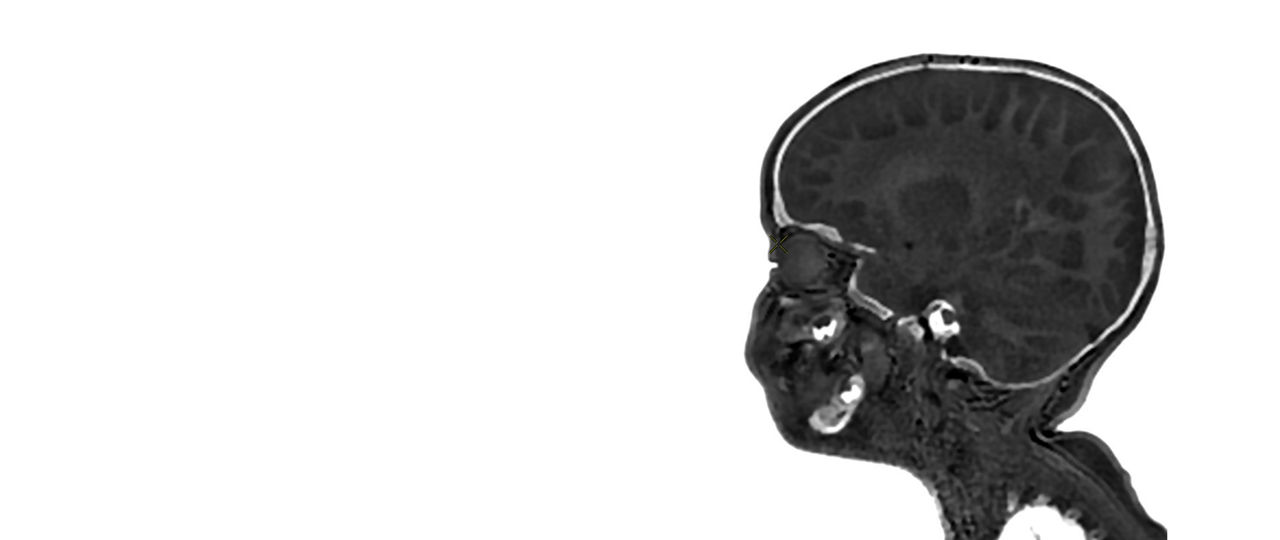 pediatric-mri-signa-header-ci-en