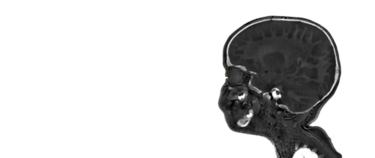 pediatric-mri-signa-header-ci-en