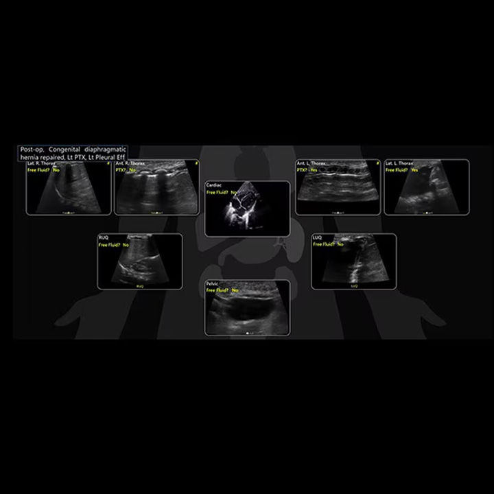 pediatrics-nicu-FeatureCardFull_1-ci-en