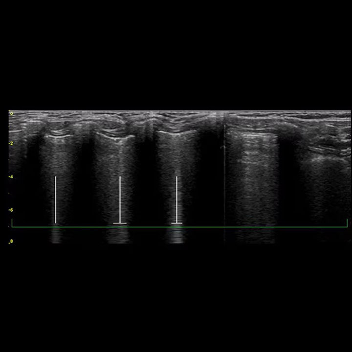 pediatrics-nicu-FeatureCardFull_2-ci-en_