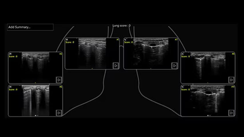 pediatrics-nicu-FeatureCardHalf_1-ci-en_