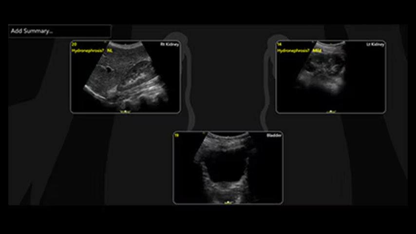 pediatrics-nicu-FeatureCardHalf_2-ci-en