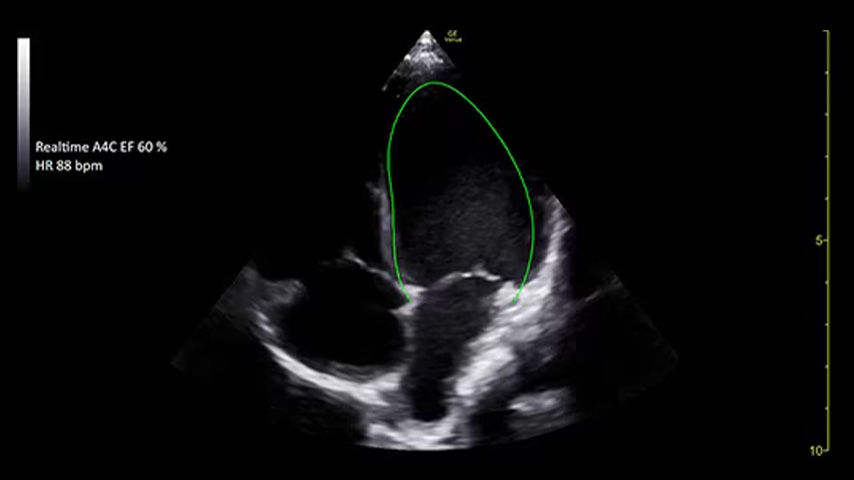 pediatrics-nicu-FeatureCardHalf_3-ci-en