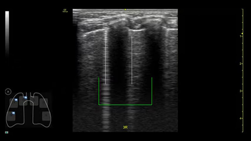 pediatrics-nicu-FeatureCardHalf_4-ci-en_
