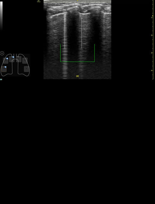 peds-auto-b-lines-desktop