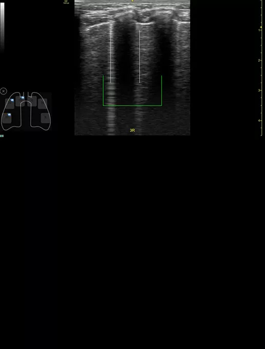 peds-auto-b-lines-desktop