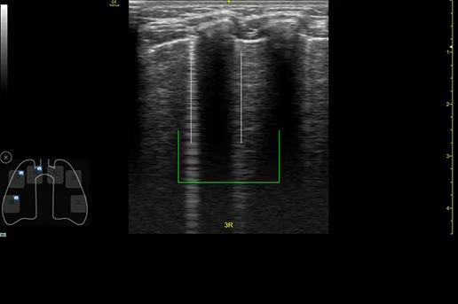 peds-auto-b-lines-desktop