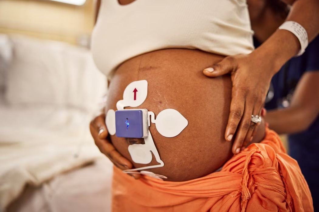 Pregnant person being monitored with Novii+Wireless patch System.
