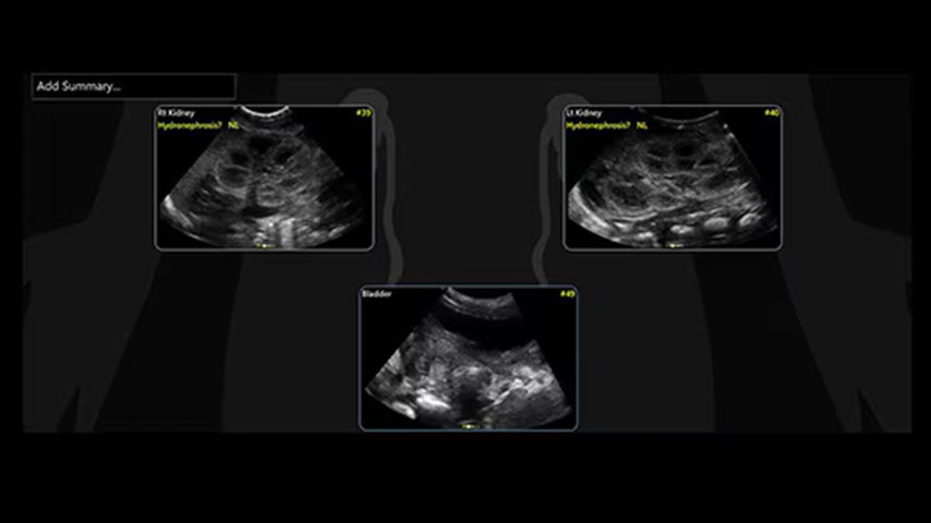 perioperative-anesthesia-Feature-Card-Half-1-ci-en
