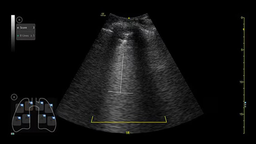perioperative-anesthesia-Feature-Card-Half-3-ci-en