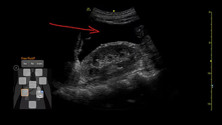 perioperative-anesthesia-Feature-Card-Half-4-ci-en