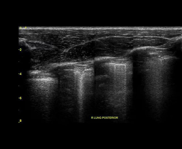 perioperative-anesthesia-featurecard1-ci-en