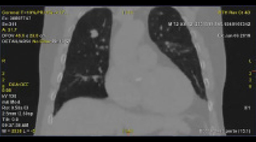 Phantom-image-with-motion-artifact-A-Full-Size