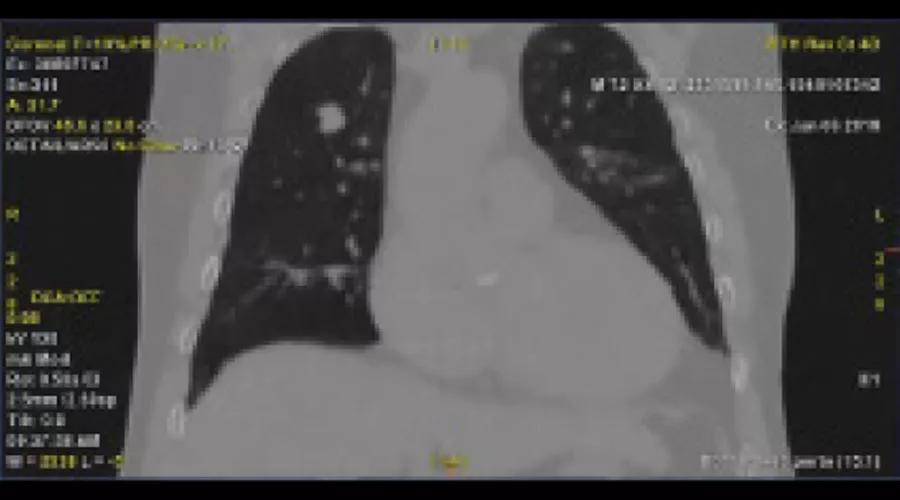 Phantom-image-with-motion-artifact-A-Full-Size