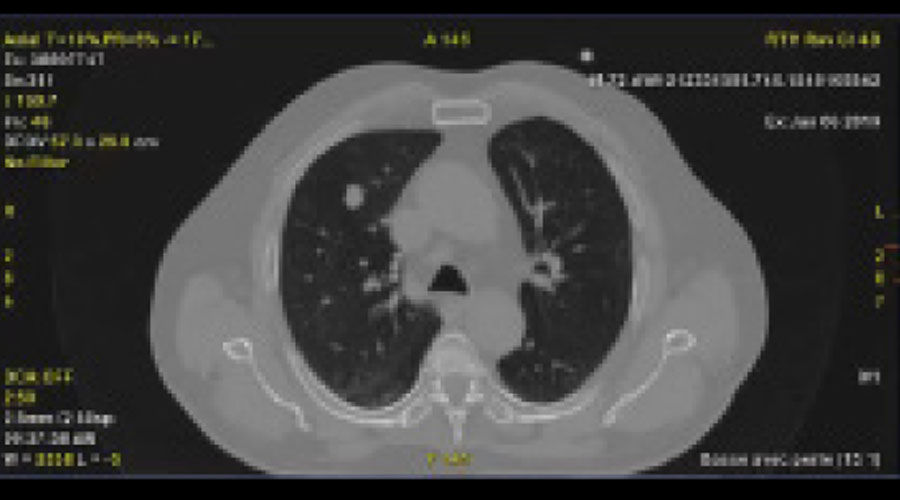 Phantom-image-with-motion-artifact-B-Full-Size