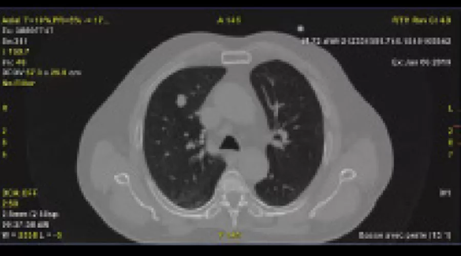 Phantom-image-with-motion-artifact-B-Full-Size