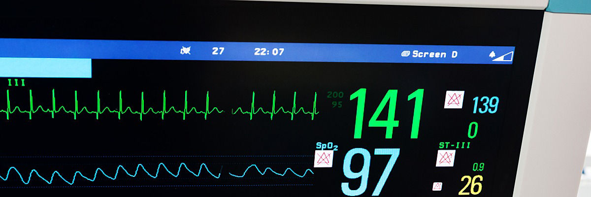 Vital signs displayed on a monitor.