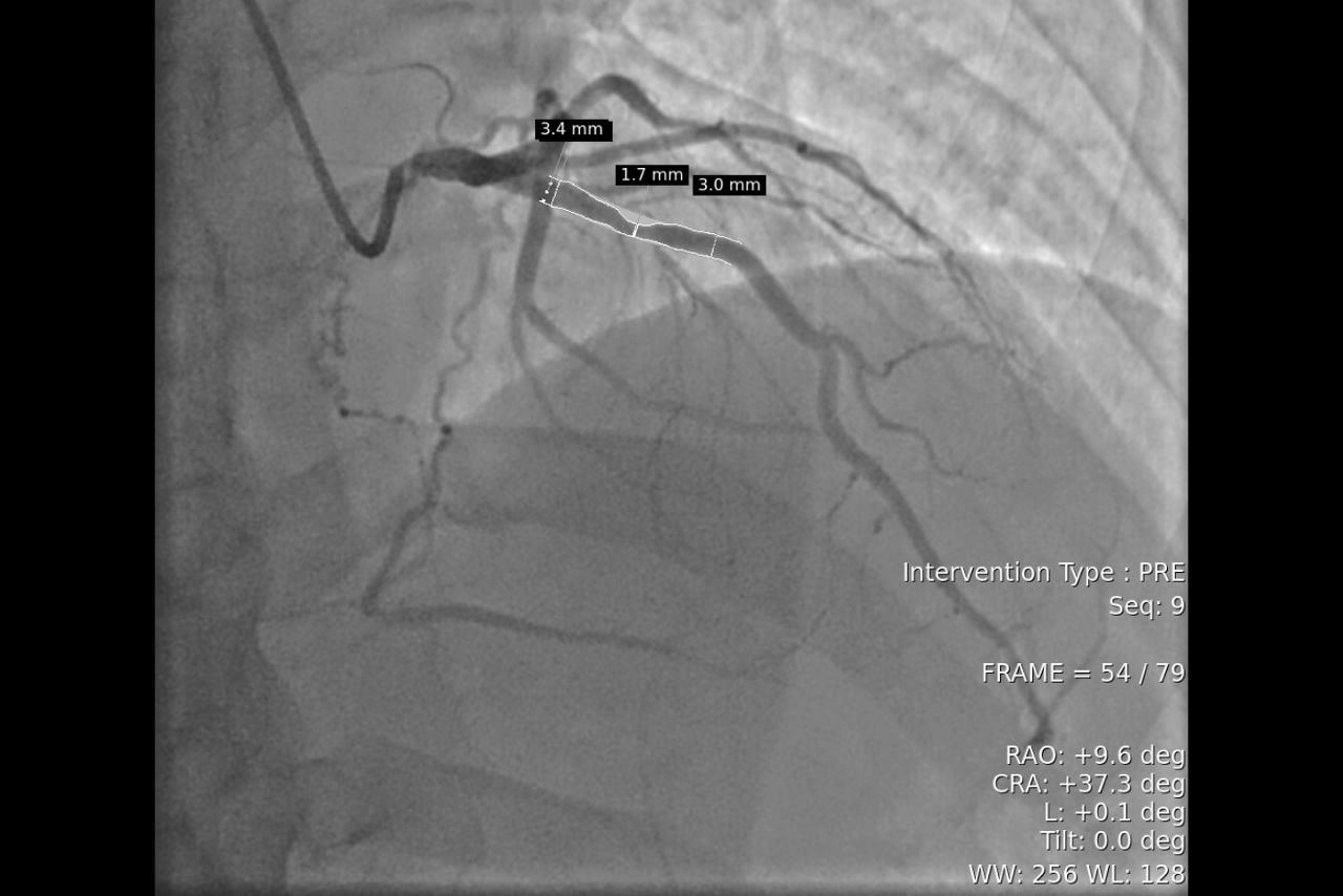 plan-desktop1-one-touch-qa-ci-en