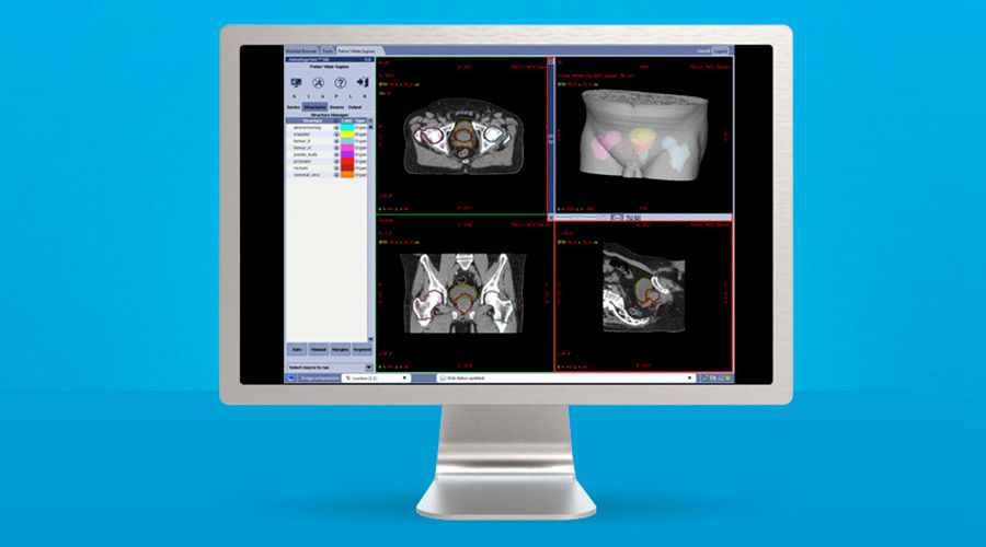 plications-advantagesim-md-gehc-advantagesim-md-spotlight-ct-atlas-segmentation-pelvis