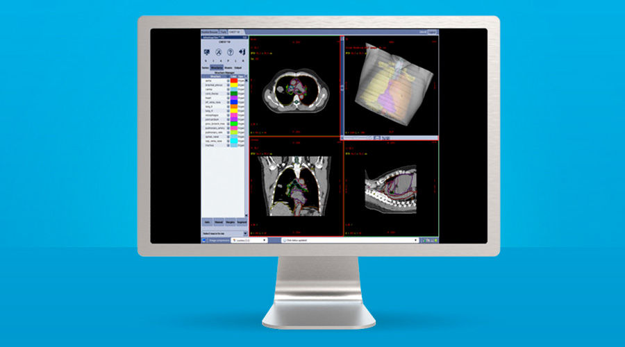 plications-advantagesim-md-gehc-advantagesim-md-spotlight-ct-atlas-segmentation-thorax