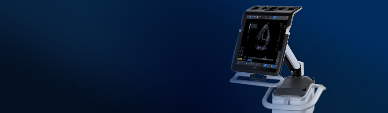 Venue Ultrasound Machine shown