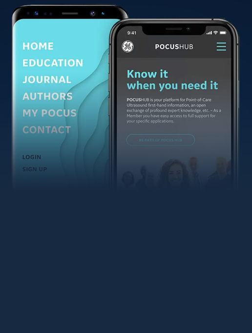 pocus-hub-featured-card-half-width-desktop-2-516x680