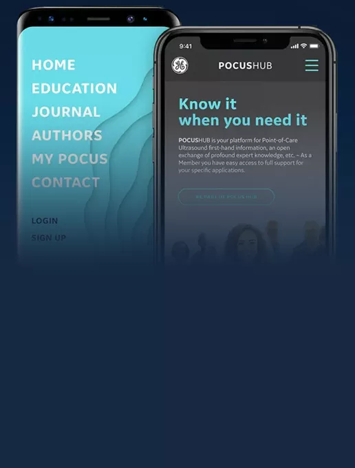 pocus-hub-featured-card-half-width-desktop-2-516x680