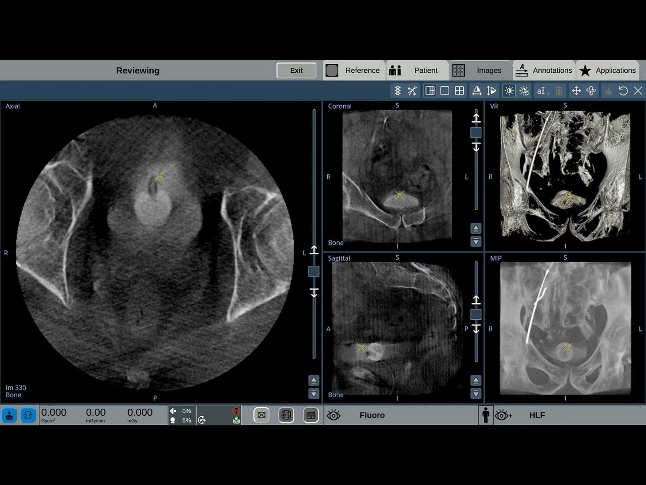 precise-interventional-imaging-features-desktop