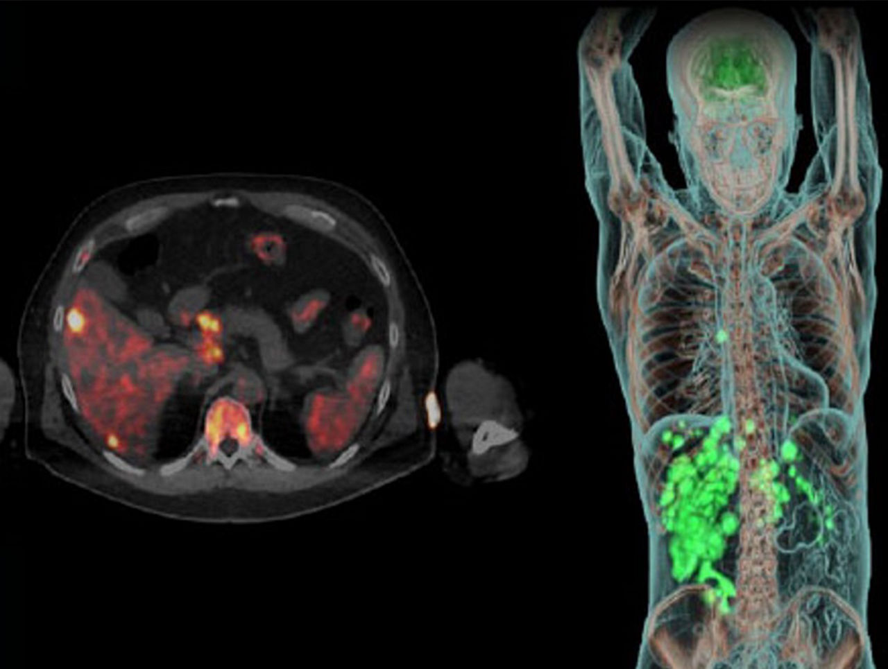 precision diagnostics and therapeutics-1300