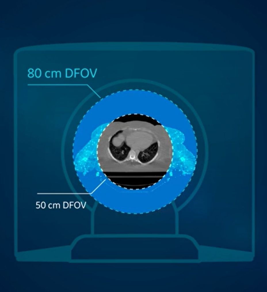 precision-hero-1-st-en