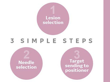 Pristina-Serena-Scurve-2-3-simple-steps-470x350