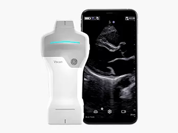 product-feature-card-vscan-air-sl-tablet-mobile