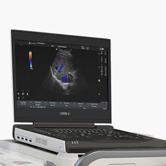 product-feature-cards-logiq-e-x-ultrasound-desktop
