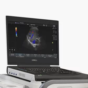 product-feature-cards-logiq-e-x-ultrasound-desktop