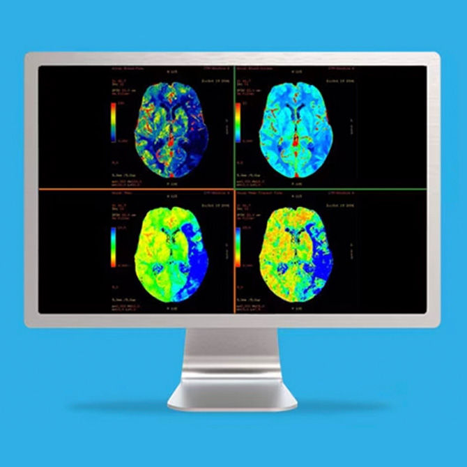 product-lister-ct-perfuston-4d-neuro