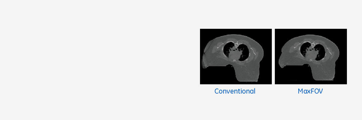 product-product-categories-computed-tomography-radiation therapy-main