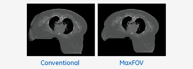 product-product-categories-computed-tomography-radiation therapy-main-640