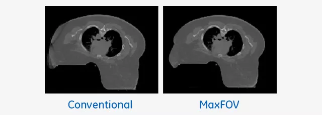 product-product-categories-computed-tomography-radiation therapy-main-640