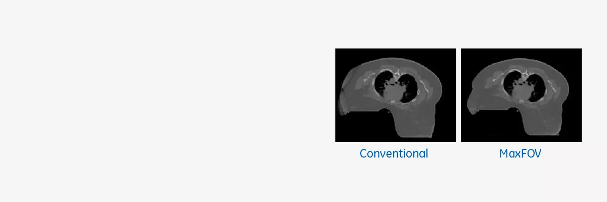 product-product-categories-computed-tomography-radiation therapy-main