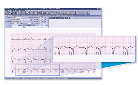 product-product-categories-diagnostic-ecg-cardio data-muse v9-clinical-expertise